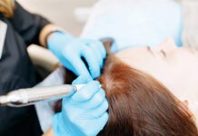 Мікропігментація шкіри голови: особливості та переваги процедури